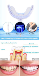 Teeth Whitening Kit - ELECTRONICS-HEAVEN